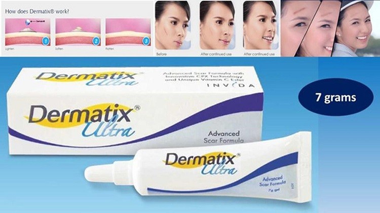 Kem trị sẹo Dermatix review giá bao nhiêu, có tốt không