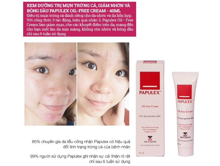 Papulex Oil - Free Cream