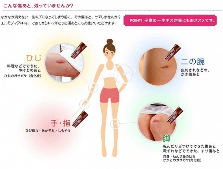 Kem cải thiện sẹo Kobayashi