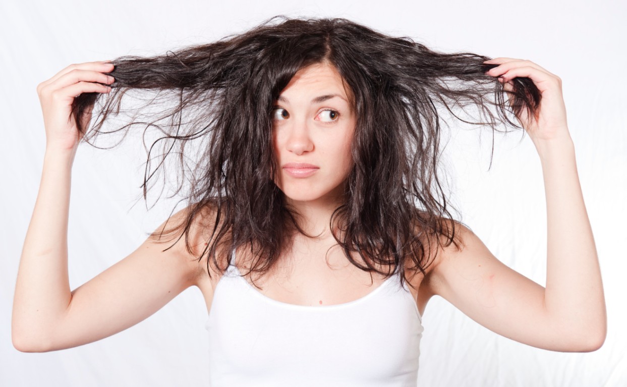 Rụng tóc do di truyền