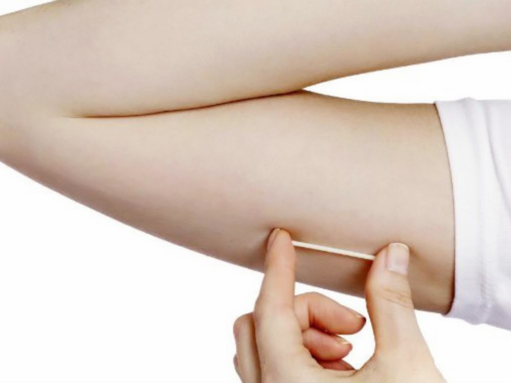 Dùng que cấy tránh thai phương pháp