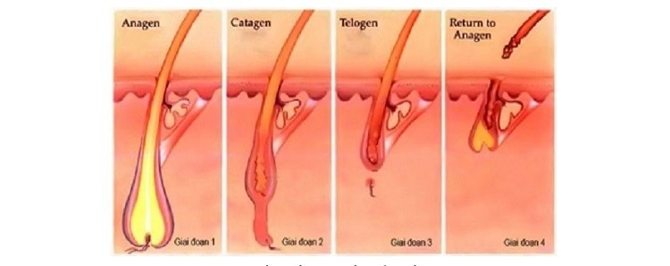 Viêm nang lông vùng kín
