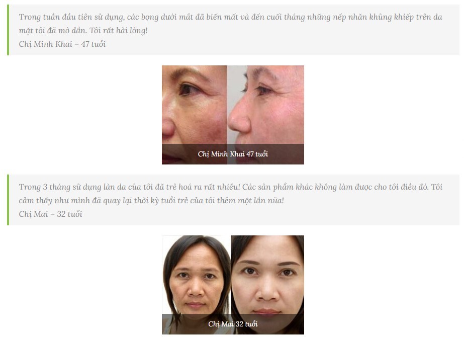 kem dakami, review kem dakami, mua kem dakami chính hãng ở đâu, review kem dakami webtretho, tác dụng của kem dakami, cách sử dụng kem dakami, kem dakami bán ở đâu, kem dakami có mấy loại, kem dakami dùng có tốt không, kem dakami có thật sự tốt không, kem dakami lừa đảo, kem dakami có tốt như quảng cáo