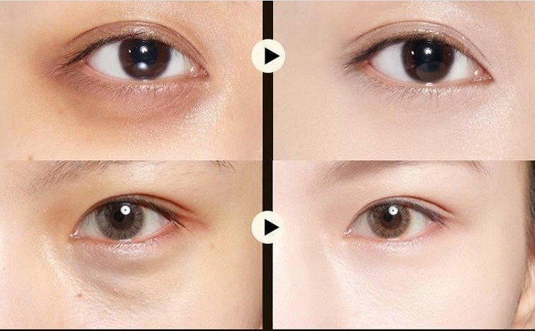Mặt nạ mắt Images review Mặt nạ mắt Images review