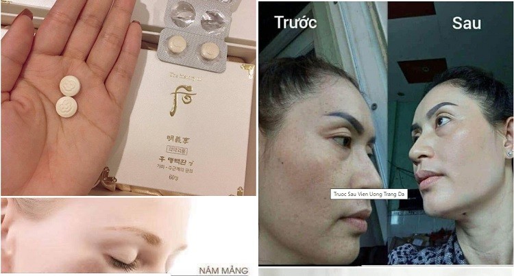 Review viên uống trắng da Whoo viên uống trắng da trị nám Whoo, review viên uống trắng da Whoo, viên uống trắng da Whoo có tốt không, viên uống trắng da hàn quốc Whoo, viên uống trắng da the history of Whoo, viên uống trắng da của Whoo, liệu trình viên uống trắng da Whoo, viên uống trắng da của hàn Whoo, viên uống trắng da mờ nám Whoo, cách sử dụng viên uống trắng da Whoo, viên uống trắng da trị nám của Whoo, viên uống trắng da trị nám Whoo có tốt không