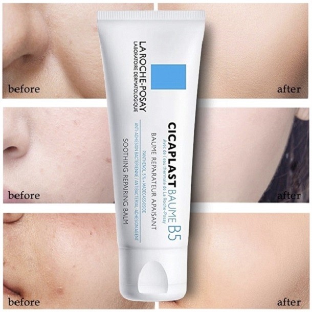 kem dưỡng ẩm cho da treatment, review kem dưỡng ẩm cho da treatment, kem dưỡng ẩm phục hồi cho da treatment, kem dưỡng ẩm cho da dầu treatment, kem dưỡng ẩm cho da dùng treatment